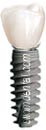 Procera Crown on Implant with Beautiful Teeth Now, dental implant