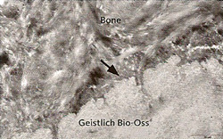 Macroporous mineral structure of Geistlich Bio-Oss
