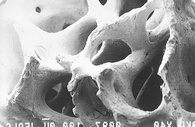 Macroporous mineral structure of human bone